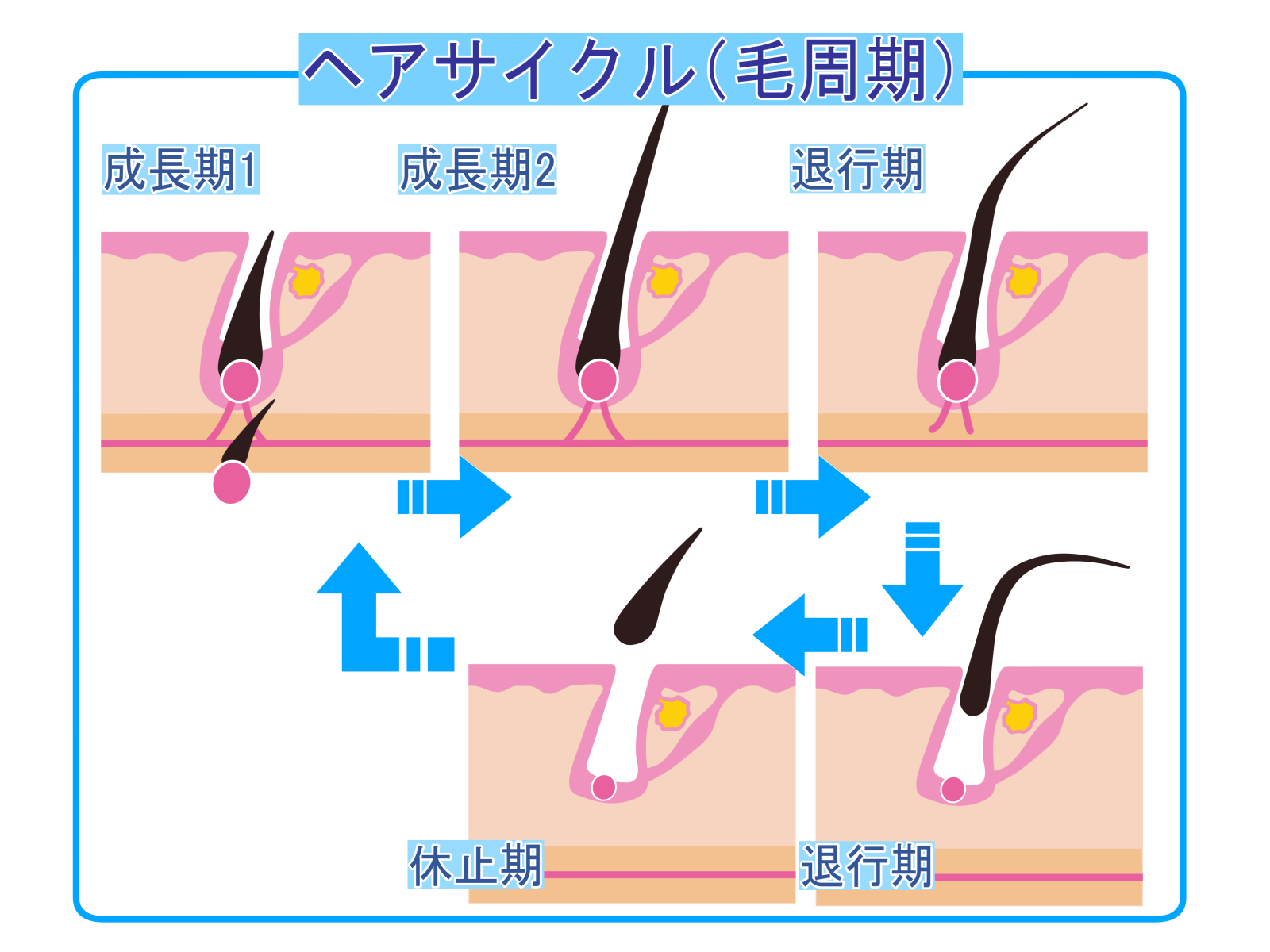 ａｇａ治療の副作用は禿で悩むより深刻だった これってどうなのよ